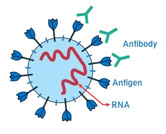 Three methods of Covid-19 detection