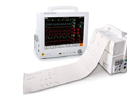 Medical Equipment Specialized Cardiovascular Patient Monitor