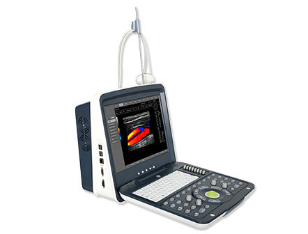 Portable Digital Color Doppler Diagnostic Ultrasound System/Machine