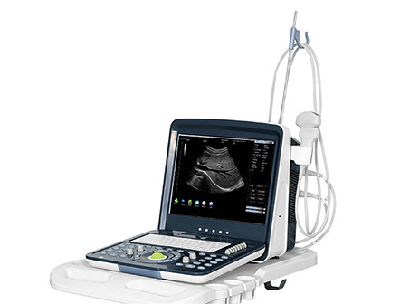 Portable Laptop Full Digital 15 Inch LCD B/W Ultrasonic Diagnostic System/Ultrasound Machine