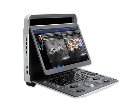 Laptop Automatic Portable Color Doppler Ultrasound Scanner