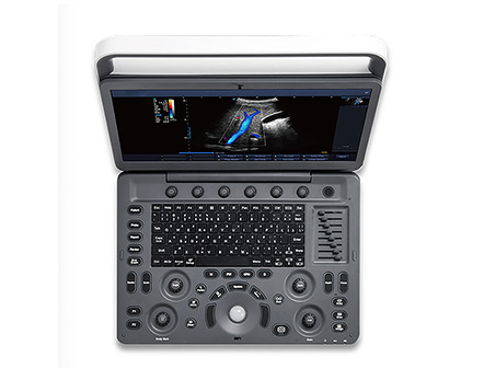 Laptop Automatic Portable Color Doppler Ultrasound Scanner