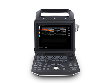 Portable 12 Inch LED Full Digital Color Doppler Ultrasonic System Diagnostic Ultrasound Machine