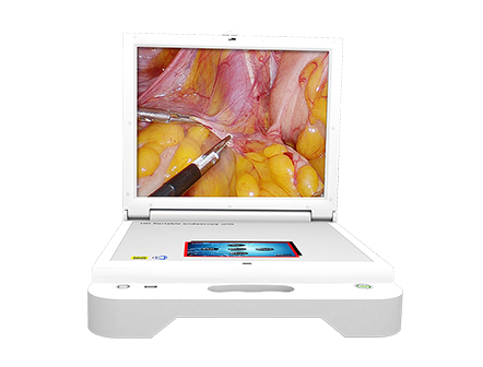 Medical Portable HD Endoscopy Unit Endoscopy Camera System with Light Source