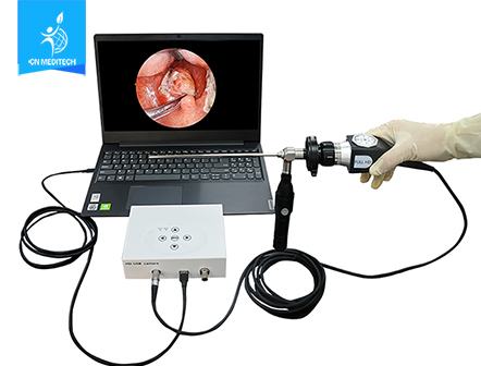 Medical Endoscope HD USB Camera 1080P LED Medical Monitor