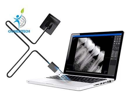 Wireless Portable Digital Dental X-ray Sensor