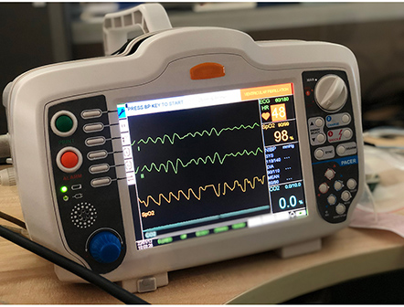 Automated Portable Electricity Biphasic Defibrillator