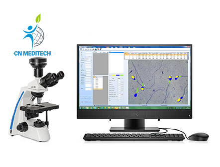 Portable Laptop Semen Analysis Sperm Analyzer