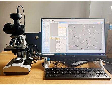 Semen Analysis Machine Microscope Sperm Quality Analyzer