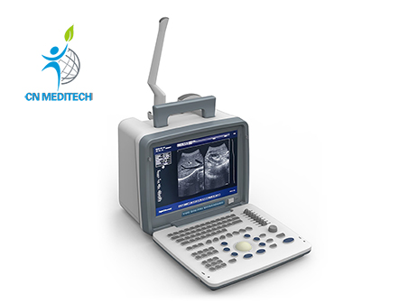 Full Digital Laptop Ultrasound Scanner B/W Portable Ultrasound Machine