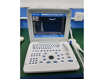 Full Digital Laptop Ultrasound Scanner B/W Portable Ultrasound Machine