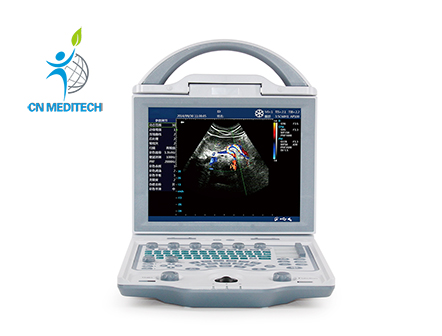 Medical Full Digital Color Doppler Pregnancy Ultrasound Scanner