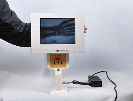 Radiography Fluoroscopy Portable X-ray System Machine