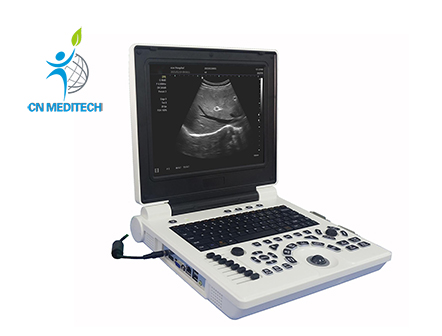 Portablel B/W Ultrasound Machine