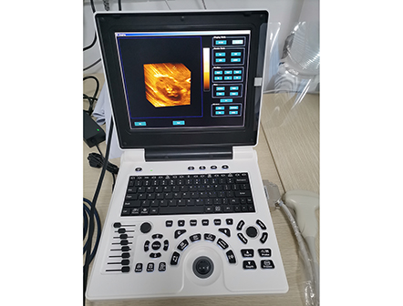 Portablel B/W Ultrasound Machine