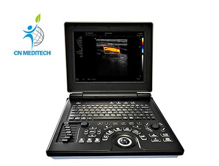 Laptop Color Doppler Ultrasonic Diagnostic System