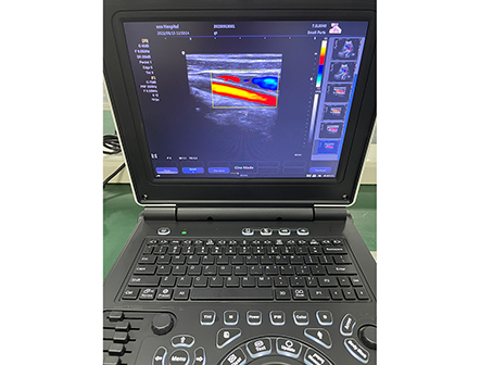 Laptop Color Doppler Ultrasonic Diagnostic System