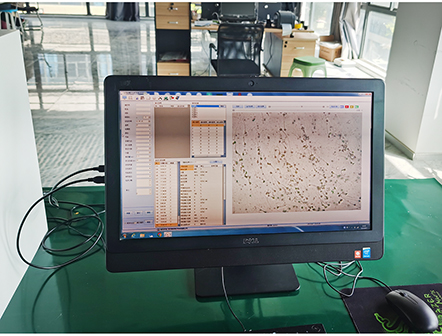 Computer Assisted Semen Analyzer Sperm Quality Analyzer