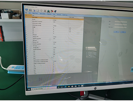 Portable Laptop Semen Analysis Sperm Analyzer