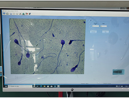 Portable Laptop Semen Analysis Sperm Analyzer