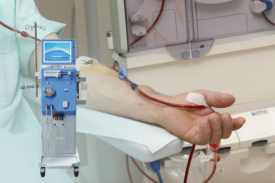 What Does A Dialysis Machine Do?