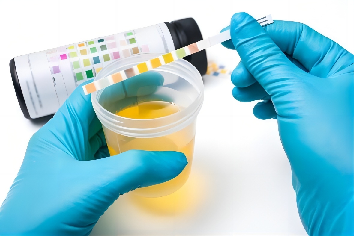 Understanding Urine Tests