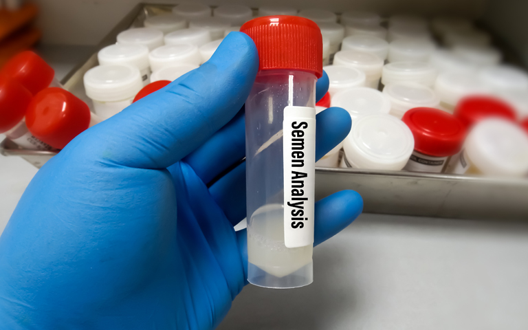 How Do You Examine Sperm?