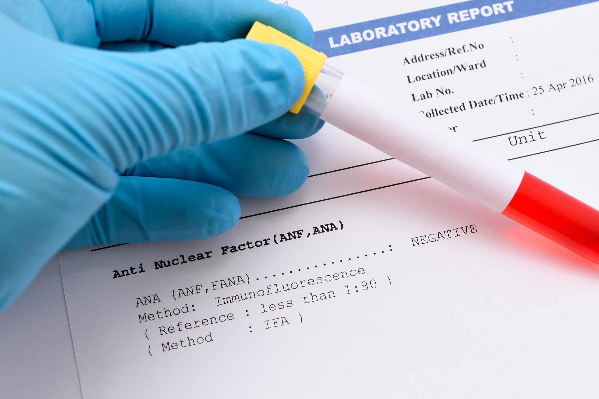 What Is An Immunofluorescence Test Used For?
