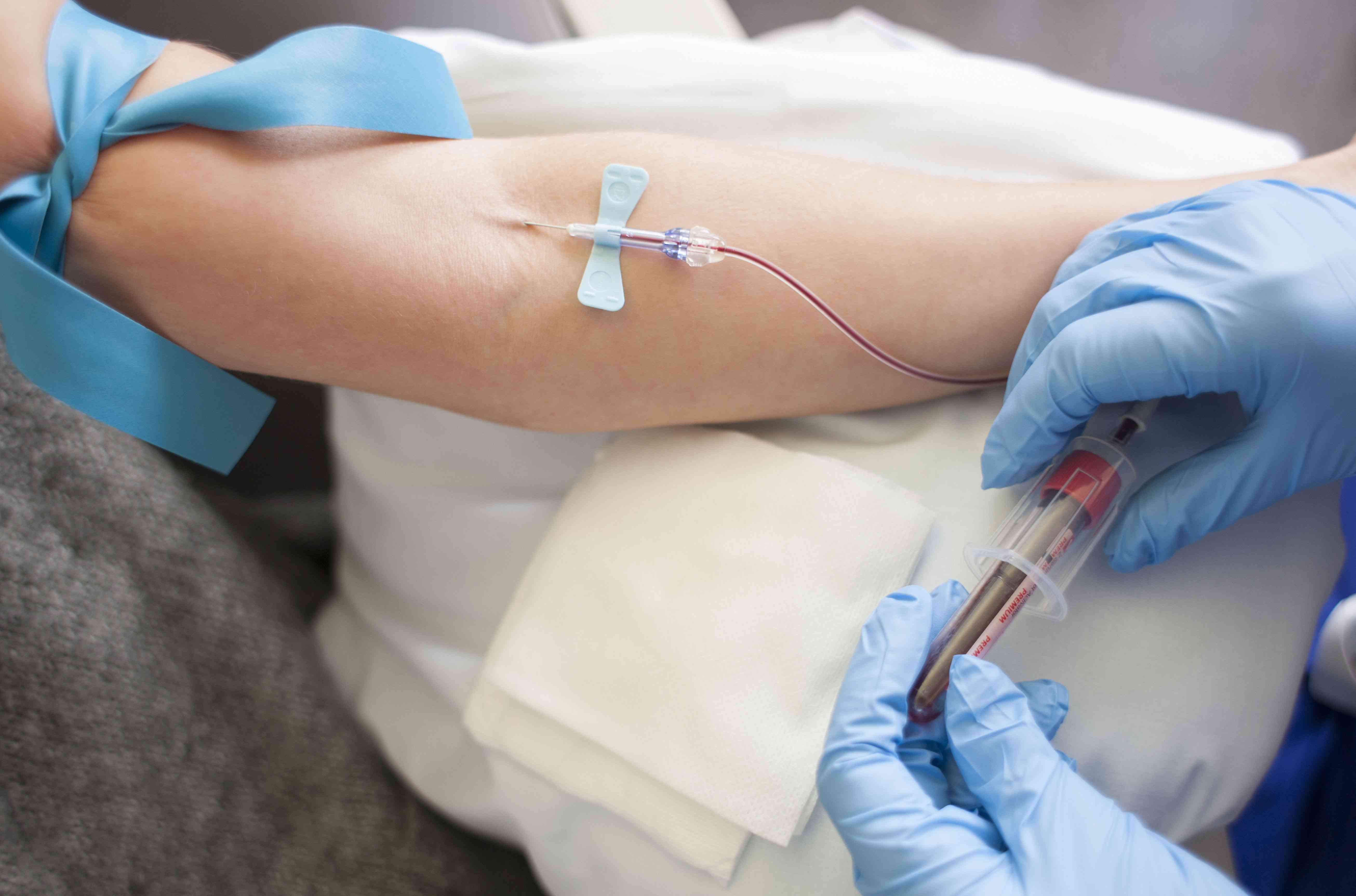 Blood Gas Analyzer