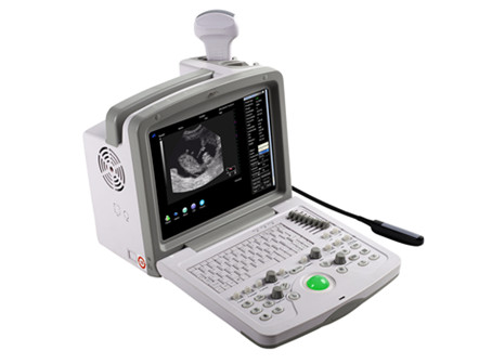 B-Ultrasound Diagnostic System